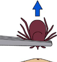 [Image: remove-b.jpg]